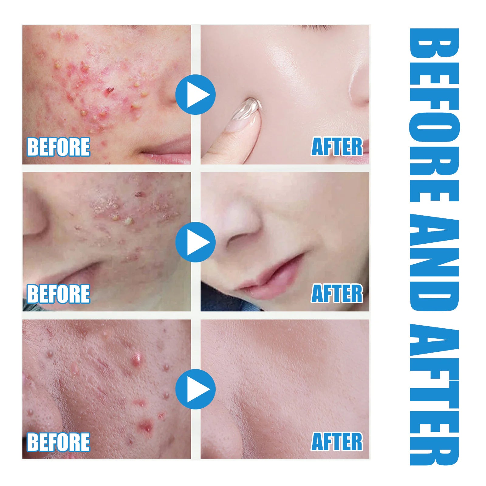 Hydro Boost Hyaluronic Serum