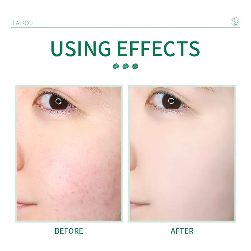 Centella Refresh Facial Cleanser 50g