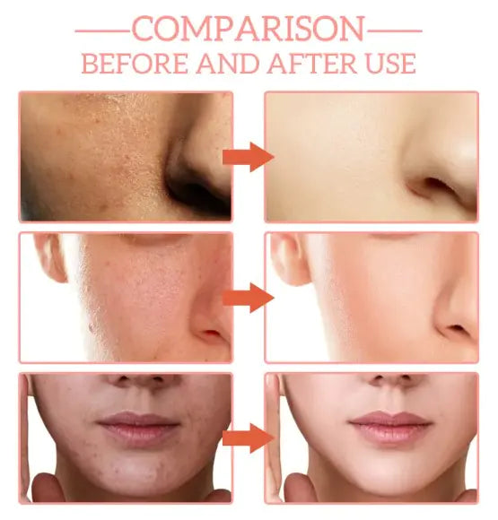 5x Firming Youth Serum