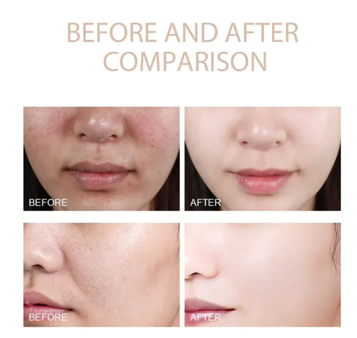 Smooth Radiance Exfoliating Gel